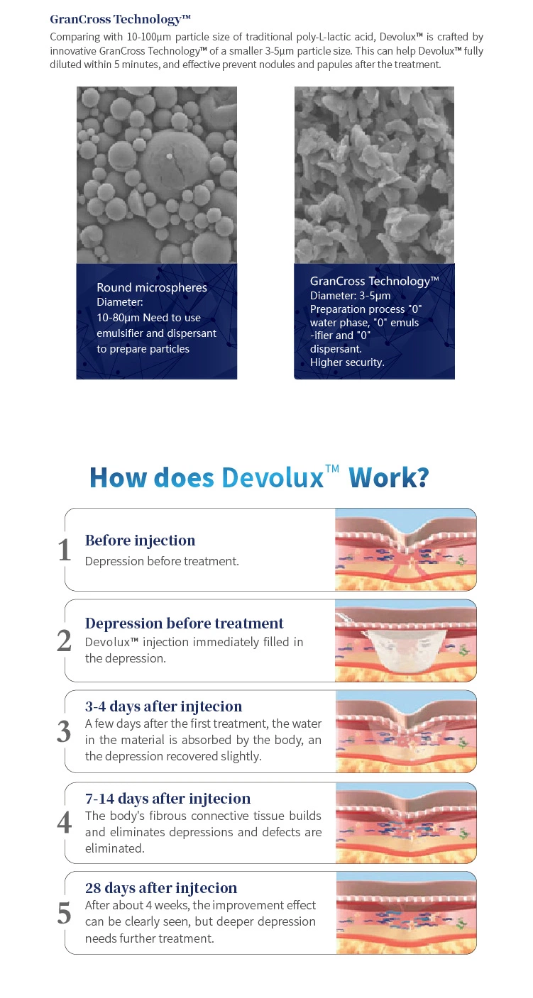 Devolux CE Approved Plla Poly-L-Lactic Acid Poly-L-Lact Relleno Injection